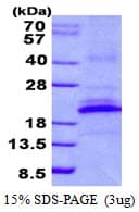 Human KLRB1 / CD161 Protein (Recombinant His)