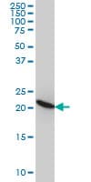 RPL9 / Ribosomal Protein L9 Antibody (clone 2F11)