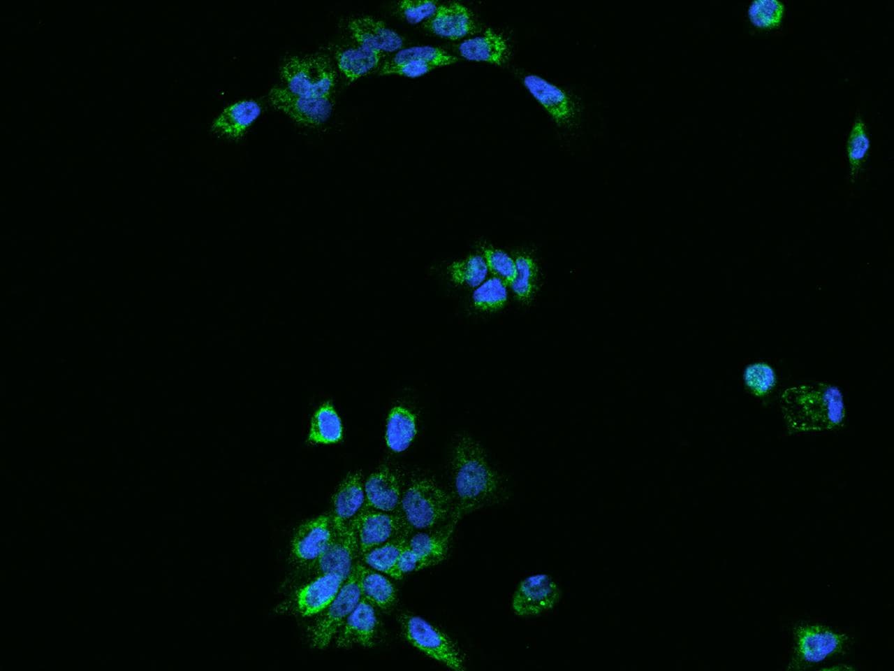 OXCT1 Antibody