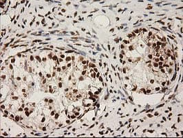 LOX / Lysyl Oxidase Antibody (clone OTI9G2)
