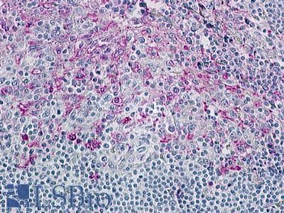 IHC-plus™ CCR8 / CD198 Antibody (Cytoplasmic Domain)