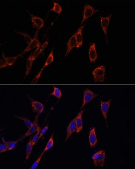 PINK1 Antibody