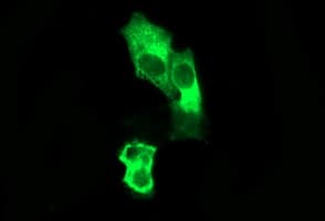 IHC-plus™ SYP / Synaptophysin Antibody (clone 4A2)