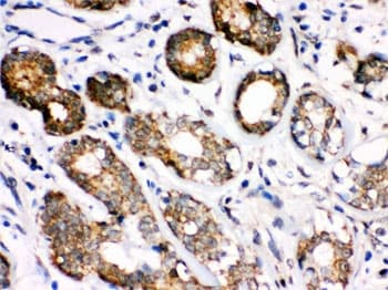 Polyclonal Rabbit anti-Human HSPA8 / HSC70 Antibody (IHC, WB)