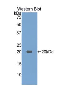 IFN Beta / Interferon Beta Antibody (aa23-169)