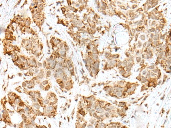 ZKSCAN1 / ZNF36 Antibody
