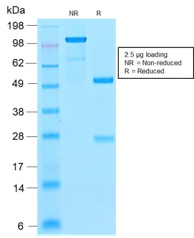 PathPlus™ Recombinant Monoclonal Rabbit anti-Human FTL / Ferritin Light Chain Antibody (clone FTL/2338R, aa 38-165, IHC, WB)