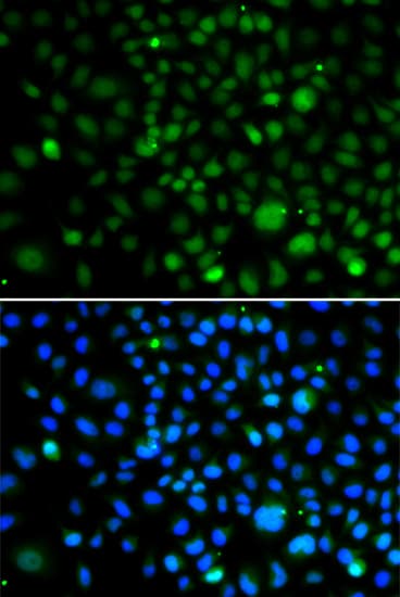 KLF15 Antibody