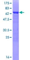Human PME-1 / PPME1 Protein (Recombinant GST)
