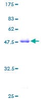 Human SAA4 Protein (Recombinant GST)