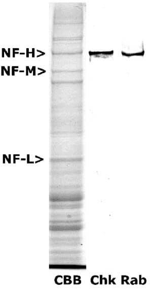 NEFH / NF-H Antibody