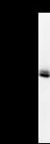 KIF2C / MCAK Antibody (clone 2488C3a)