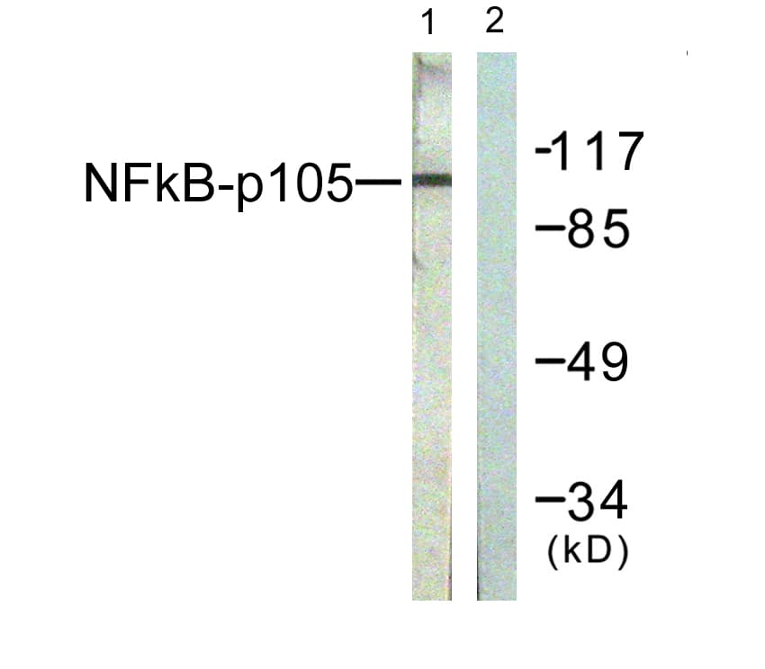 NFKB1 / NF-Kappa-B Antibody (aa896-945)