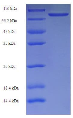 Human RBMY1F Protein (Recombinant His-SUMO)