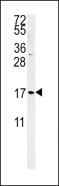 Polyclonal Rabbit anti-Human SMAGP Antibody (aa46-75, IHC, WB)