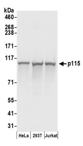 Polyclonal Rabbit anti-Human US01 / p115 Antibody (aa912-962, IHC, WB)