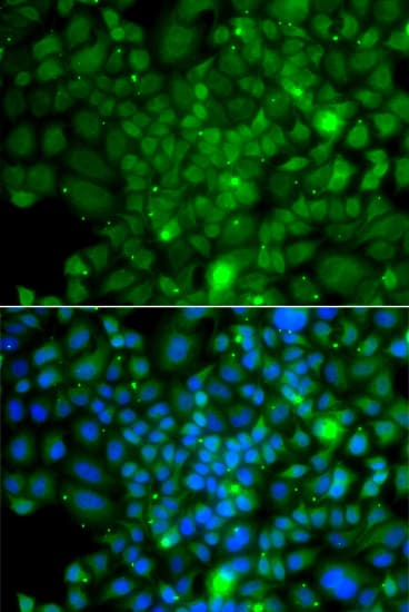 Polyclonal Rabbit anti-Human RRAGA Antibody (IF, WB)