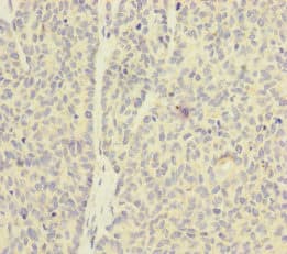 SKIV2L / SKI2 Antibody