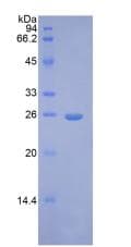 Human FGF9 Protein (Recombinant His)