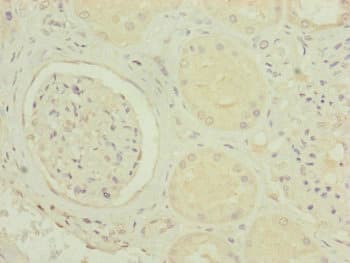 MRPS6 / MRP S6 Antibody