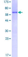 Human HOXC4 Protein (Recombinant GST)