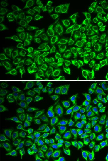 IL12RB1 / CD212 Antibody