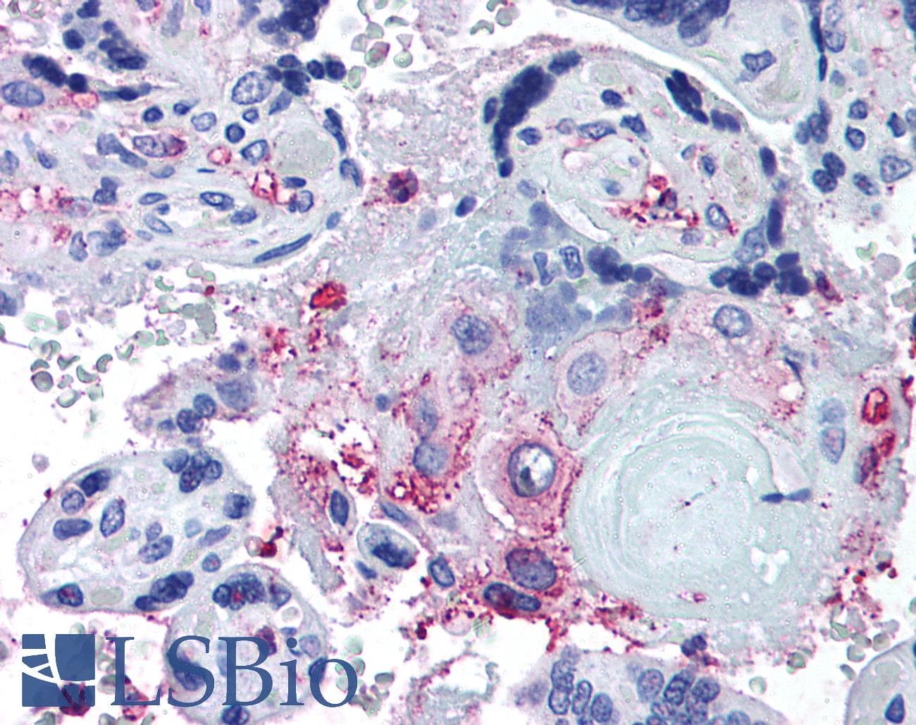 IHC-plus™ ADAMTS5 Antibody (Internal)