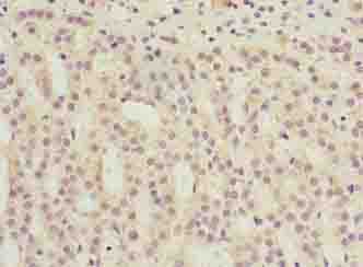 TMEM31 Antibody