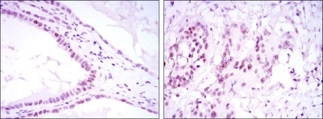 Monoclonal Mouse anti-Human SUZ12 Antibody (clone 3D10, IHC, WB)