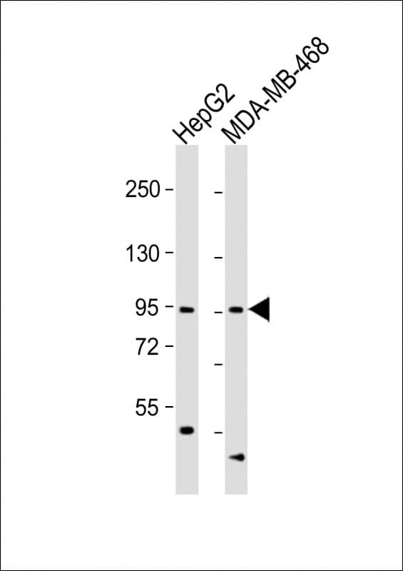 Polyclonal Rabbit anti-Human OPHN1 Antibody (aa284-315, WB)