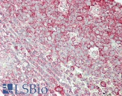 IHC-plus™ RPL7A / Ribosomal Protein L7a Antibody (aa215-C-term)
