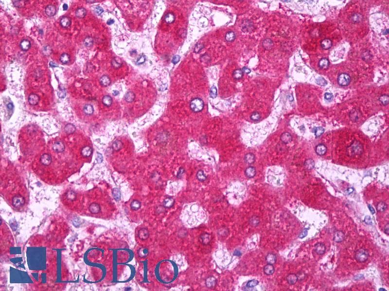 IHC-plus™ Polyclonal Rabbit anti-Human CYP2E1 Antibody (IHC, WB)
