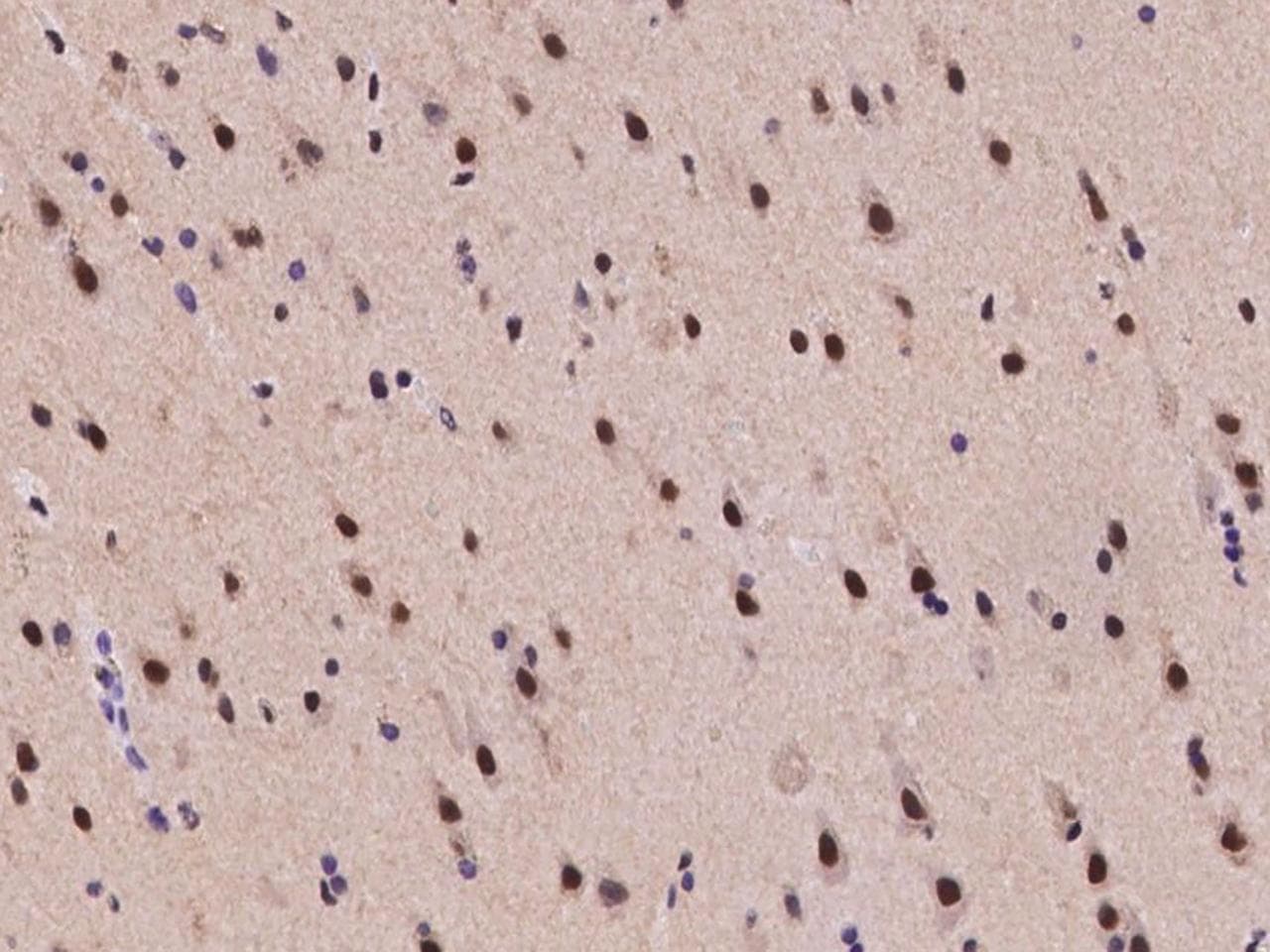 TRIM33 / TIF1-Gamma Antibody