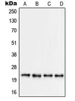 Polyclonal Rabbit anti-Human RPS9 / Ribosomal Protein S9 Antibody (Internal, IF, WB)