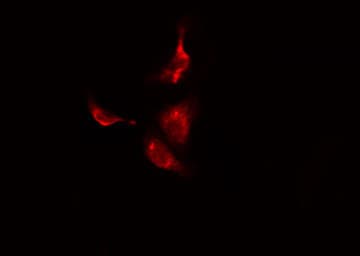 PPP2R3C Antibody
