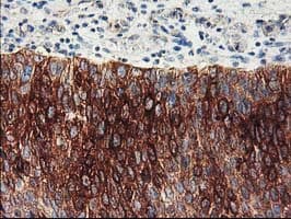 FDFT1 / Squalene Synthase Antibody (clone OTI1H9)