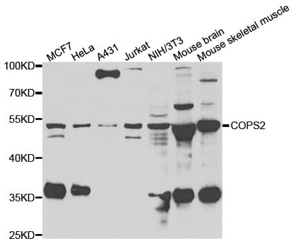 IHC-plus™ COPS2 / TRIP15 / ALIEN Antibody