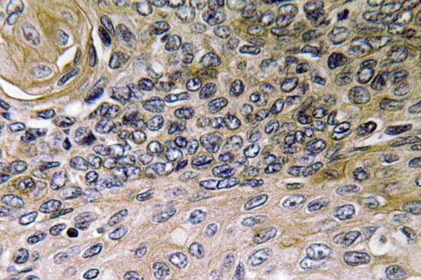 IL8 / Interleukin 8 Antibody (Val68)