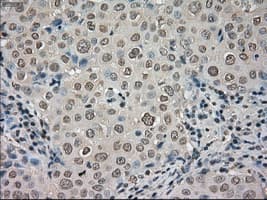 Monoclonal Mouse anti-Human NTRK3 / TRKC Antibody (clone OTI4E10, IHC, IF, WB)