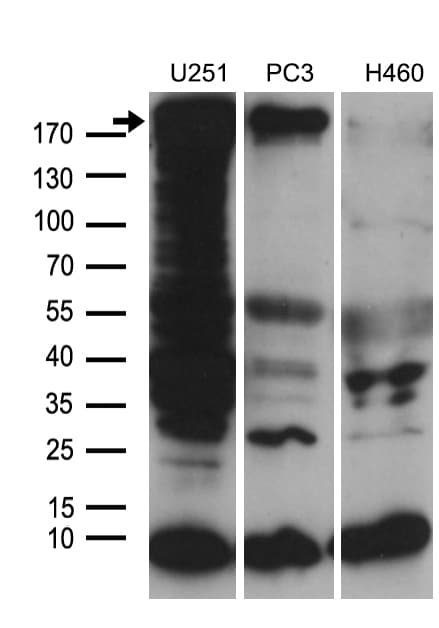 Monoclonal Mouse anti-Human NES / Nestin Antibody (clone OTI3B12, aa99-349, IHC, WB)