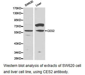Polyclonal Rabbit anti-Human CES2 / Esterase Antibody (IHC, WB)