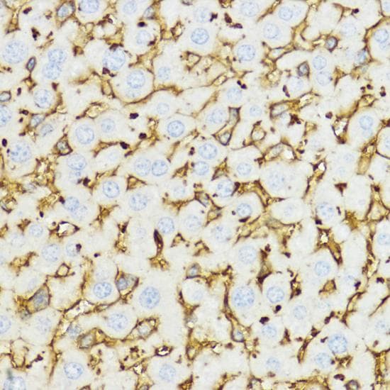 CHI3L1 / YKL-40 Antibody