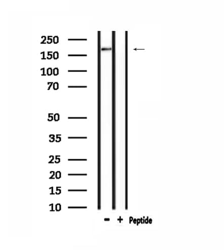 Polyclonal Rabbit anti-Human ARID1B / BAF250B Antibody (IF, WB)