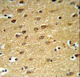 LINGO1 Antibody (aa575-603)