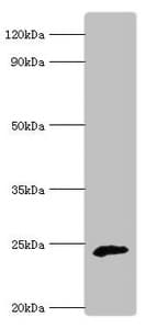 COQ7 Antibody (aa37-217)