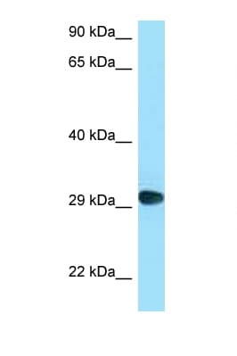 Polyclonal Rabbit anti-Human CD58 Antibody (C-Terminus, WB)