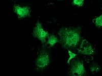MSI1 / Musashi 1 Antibody (clone OTI2A10)