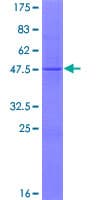 Human MRPL18 Protein (Recombinant GST)
