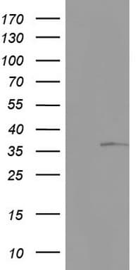 Monoclonal Mouse anti-Human KYNU Antibody (clone OTI1F1, aa1-216, WB)