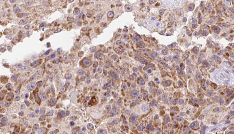 INHBA / Inhibin Beta A Antibody